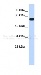 ARP32981_P050 - HIC2 / ZBTB30