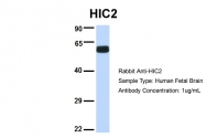 ARP32981_P050 - HIC2 / ZBTB30