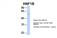 ARP32999_P050 - HNF1 beta / TCF2