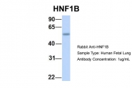 ARP32999_P050 - HNF1 beta / TCF2