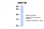 ARP32999_P050 - HNF1 beta / TCF2