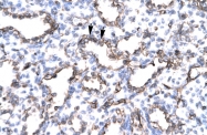 ARP33068_T100 - CD105 / Endoglin