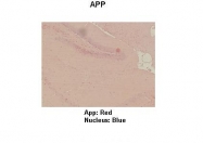 ARP33075_P050 - Amyloid beta A4 protein / APP