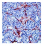 ARP33090_T100 - MMP-9