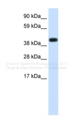 ARP33096_T100 - Heat shock protein 70 / HSP70