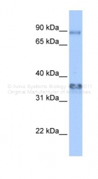 ARP33156_P050 - ZFP64 (isoforms 1 and 2)