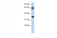 ARP33199_P050 - BAPX1 / NKX3B