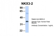 ARP33199_P050 - BAPX1 / NKX3B