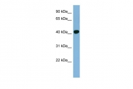 ARP33227_P050 - RING1 / RNF1