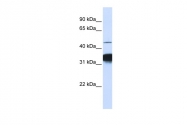 ARP33248_P050 - RXR-alpha / RXRA