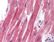 ARP33302_P050 - SNAI2 / SLUG