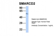ARP33310_P050 - SMARCD2