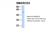 ARP33310_P050 - SMARCD2