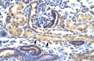 ARP33314_P050 - SNAI1