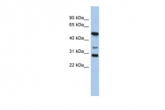 ARP33322_P050 - SOX3