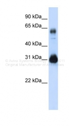 ARP33329_P050 - SOX15