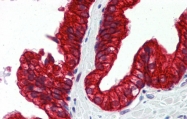 ARP33336_P050 - SP3 / SPR-2