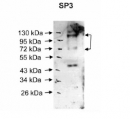 ARP33336_P050 - SP3 / SPR-2