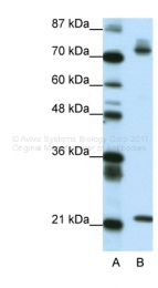 ARP33362_P050 - SATB1