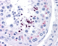 ARP33370_P050 - Cyclin D1