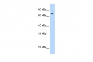 ARP33374_P050 - STAT1