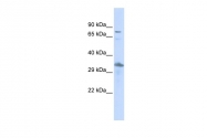 ARP33430_P050 - Thyrotroph embryonic factor (TEF)