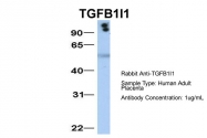ARP33442_P050 - TGFB1I1