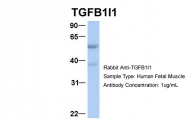 ARP33442_P050 - TGFB1I1
