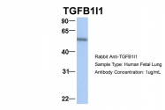 ARP33442_P050 - TGFB1I1