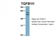 ARP33442_P050 - TGFB1I1