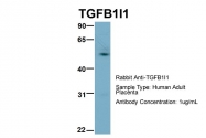 ARP33442_P050 - TGFB1I1