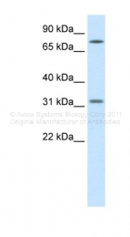ARP33491_T100 - WNT8B