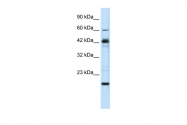 ARP33519_P050 - ZNF24