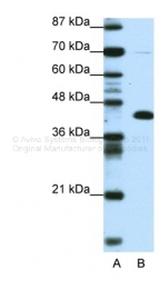 ARP33531_P050 - ZBTB25