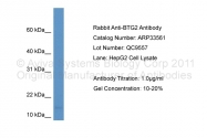 ARP33561_P050 - BTG2