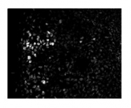 ARP33694_P050 - ZFHX1B