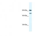 ARP33694_P050 - ZFHX1B