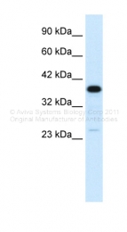 ARP33814_P050 - C4b-binding protein beta