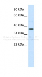 ARP33815_P050 - Alpha-2-HS-glycoprotein / AHSG
