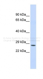 ARP33873_P050 - Chymotrypsin C