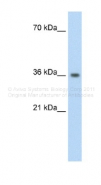 ARP33878_T100 - PHYHIP