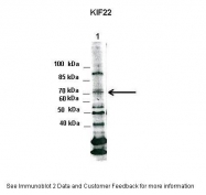 ARP33919_P050 - KIF22