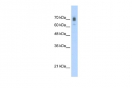 ARP33920_T100 - KIF22