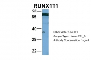 ARP33996_T100 - RUNX1T1