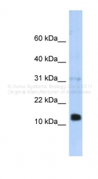 ARP34029_P050 - REG1B