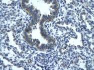 ARP34044_P050 - RGS19
