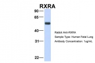 ARP34060_P050 - RXR-alpha / RXRA
