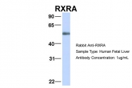 ARP34060_P050 - RXR-alpha / RXRA