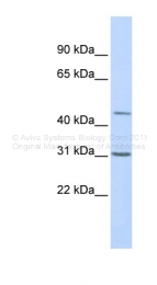 ARP34065_P050 - TEAD3 / TEF5