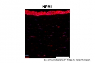 ARP34094_T100 - Nucleophosmin
